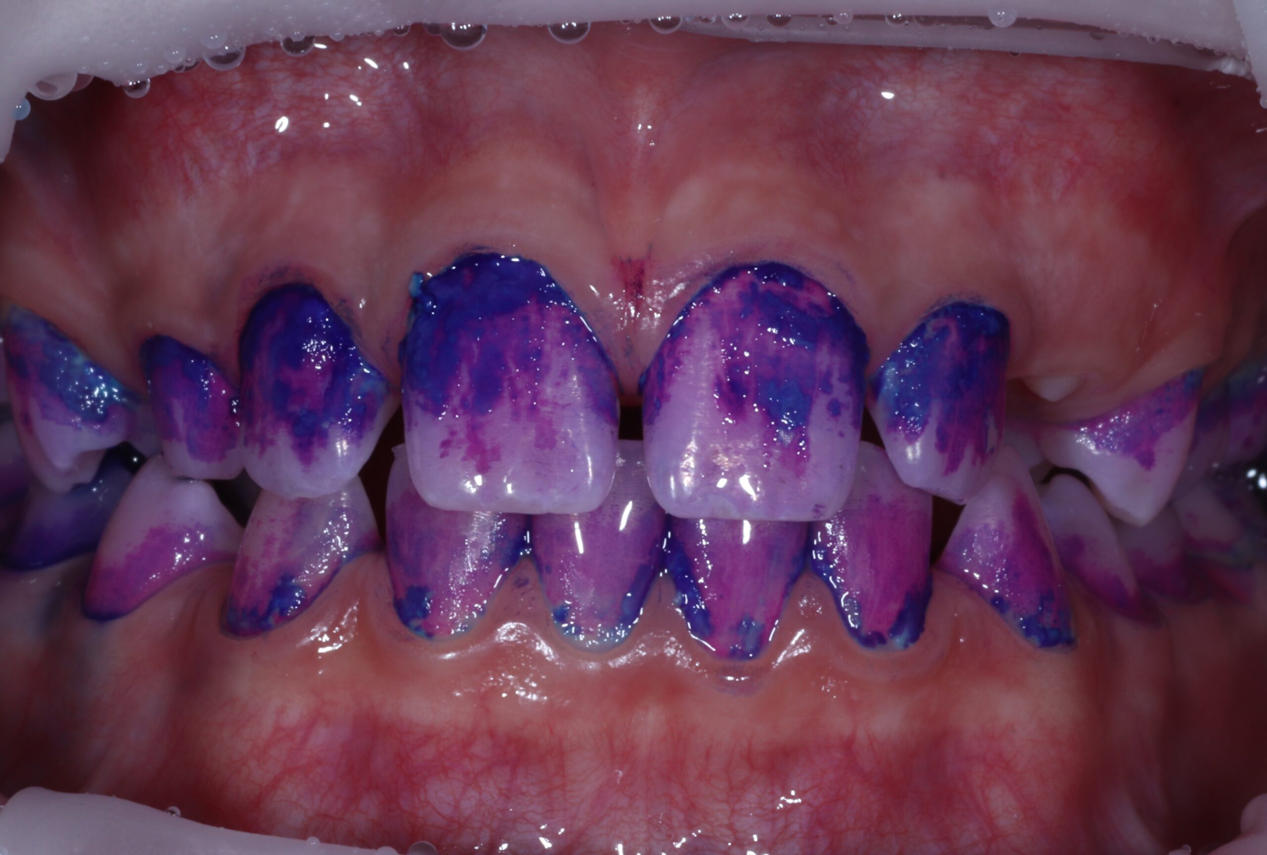Before image
