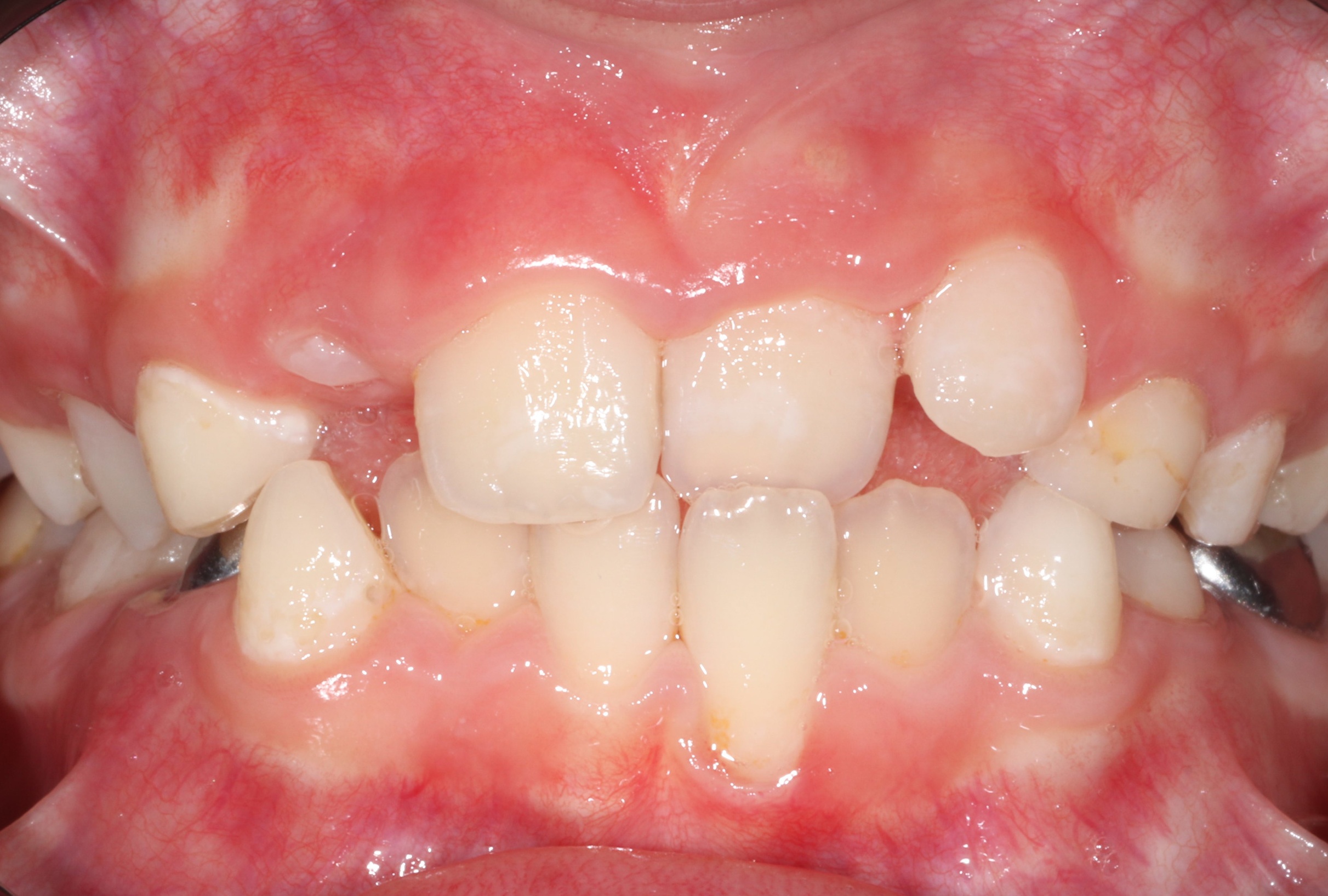 Before image