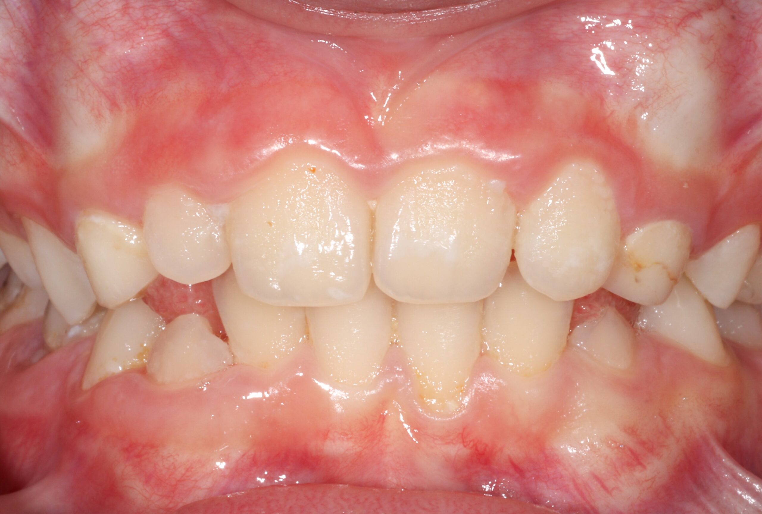 After image