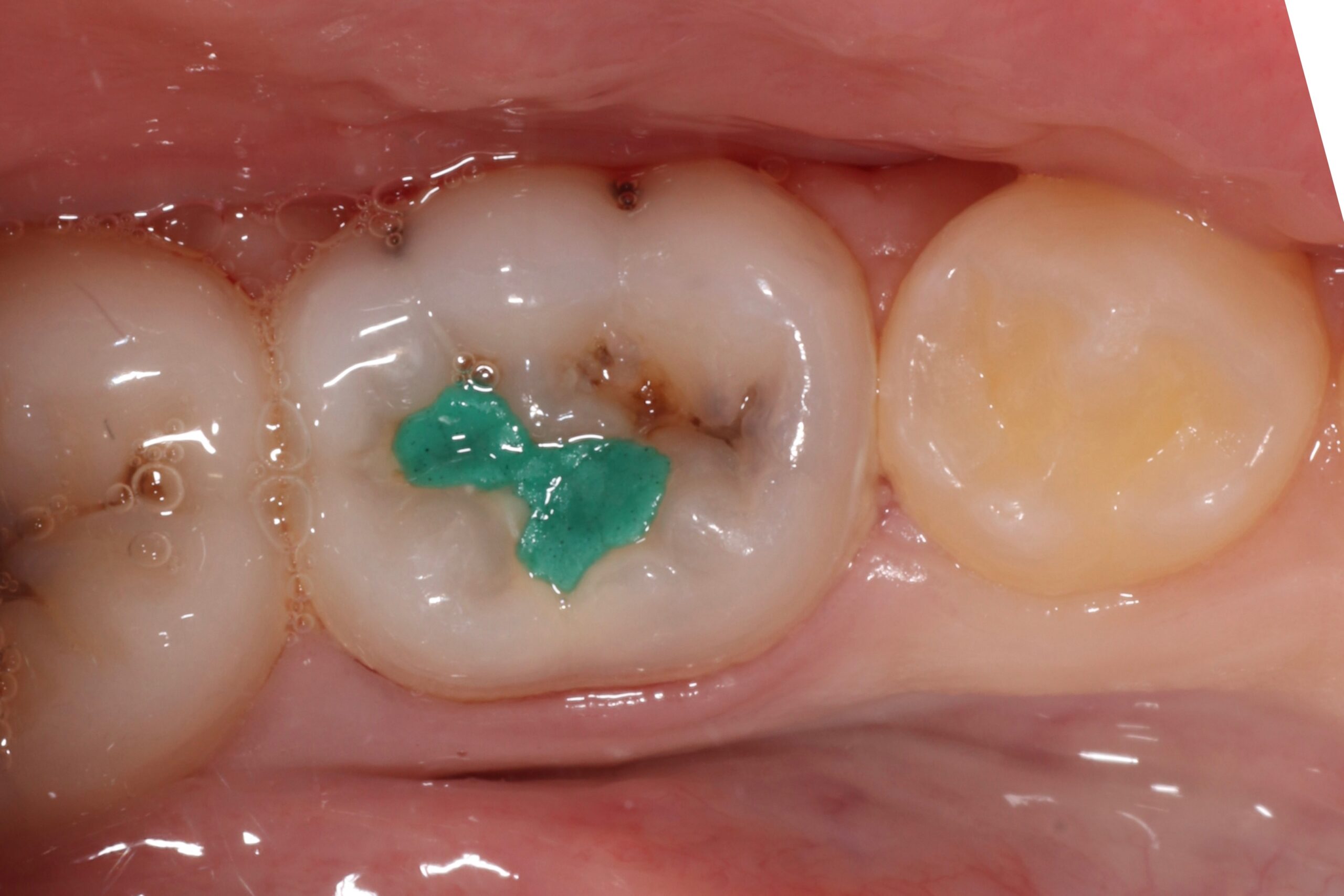 Before image