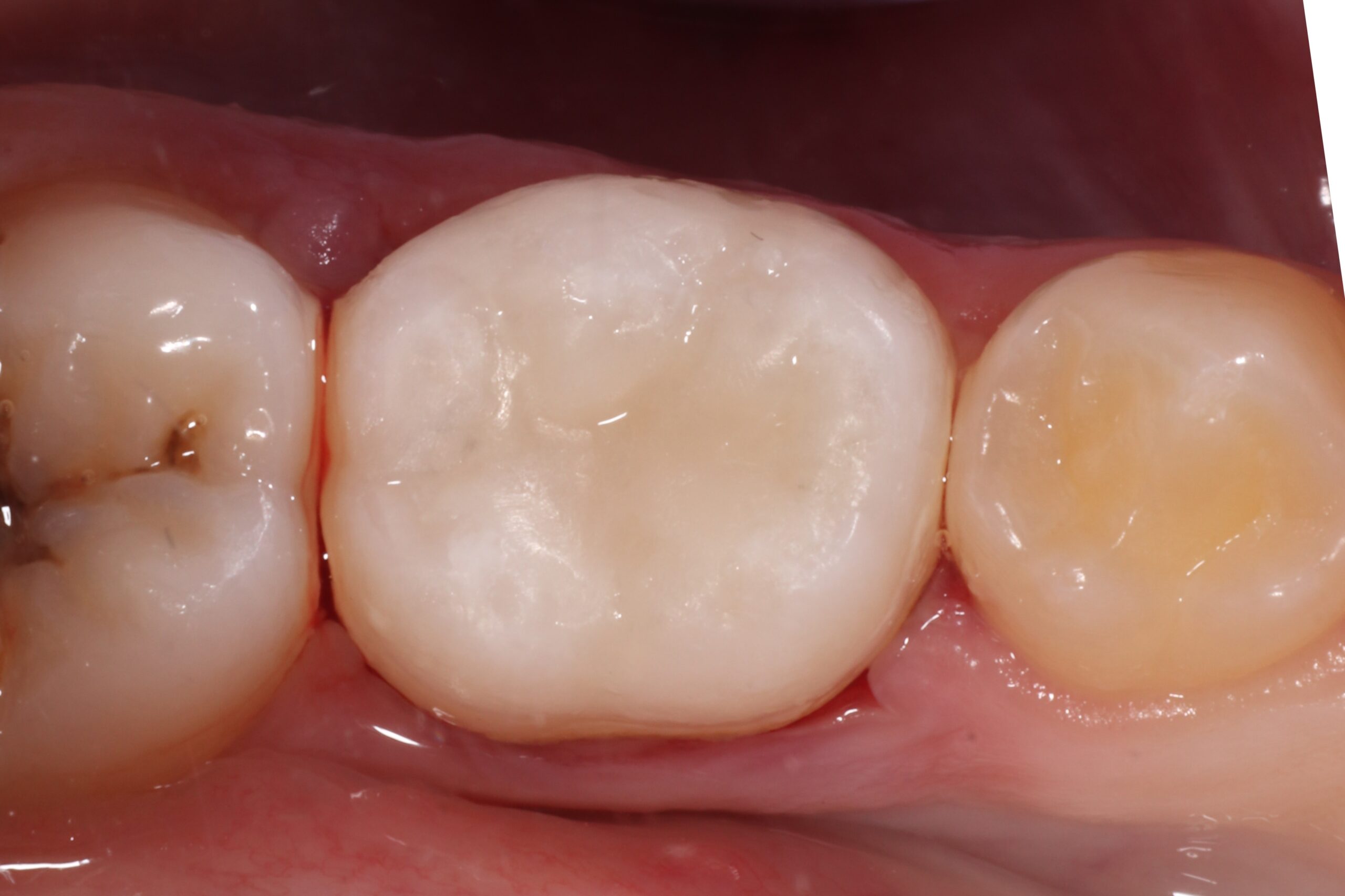 After image