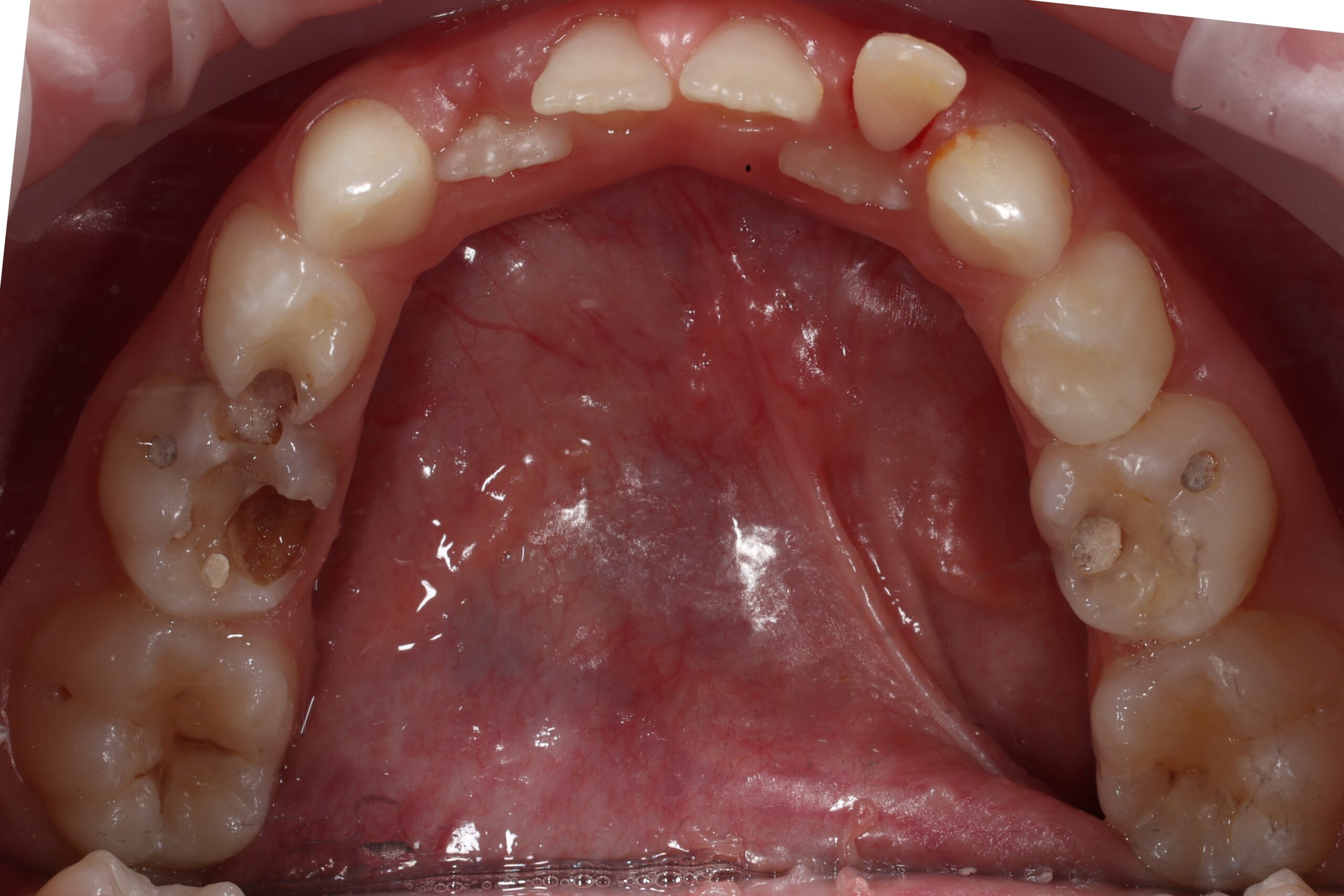 Before image