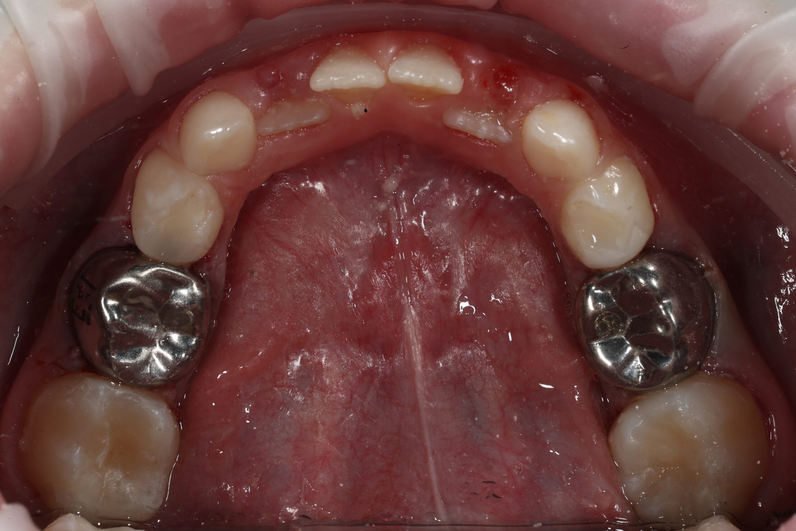 After image
