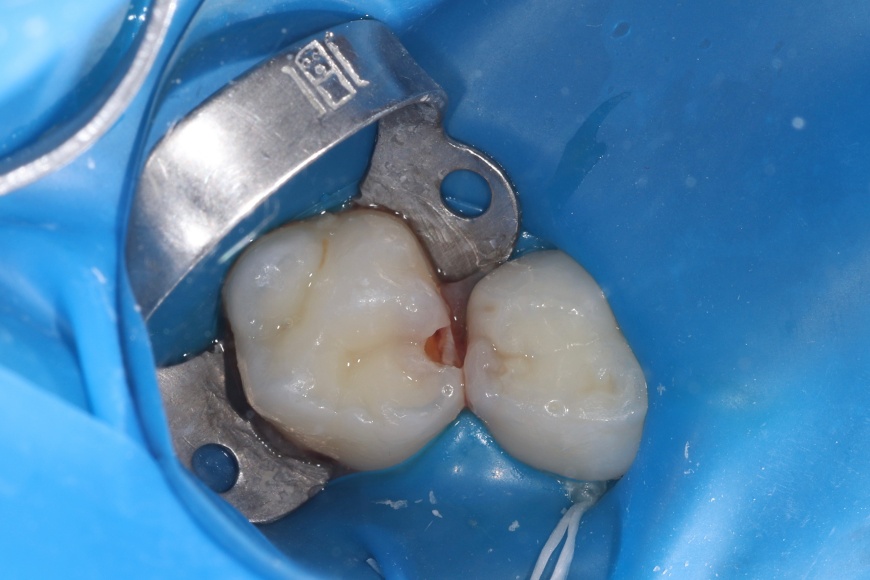 Before image