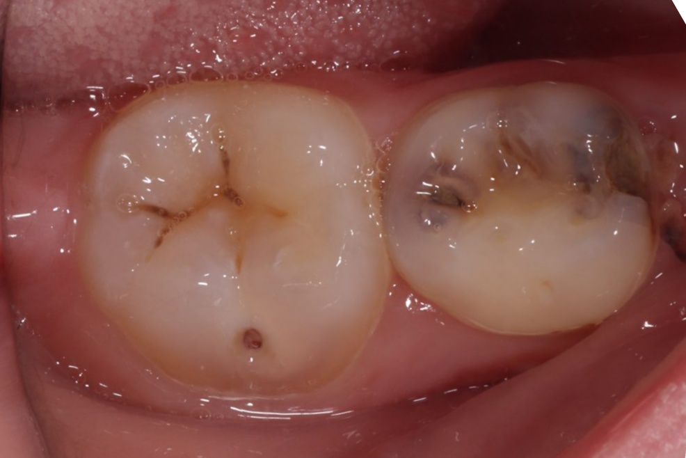 Before image