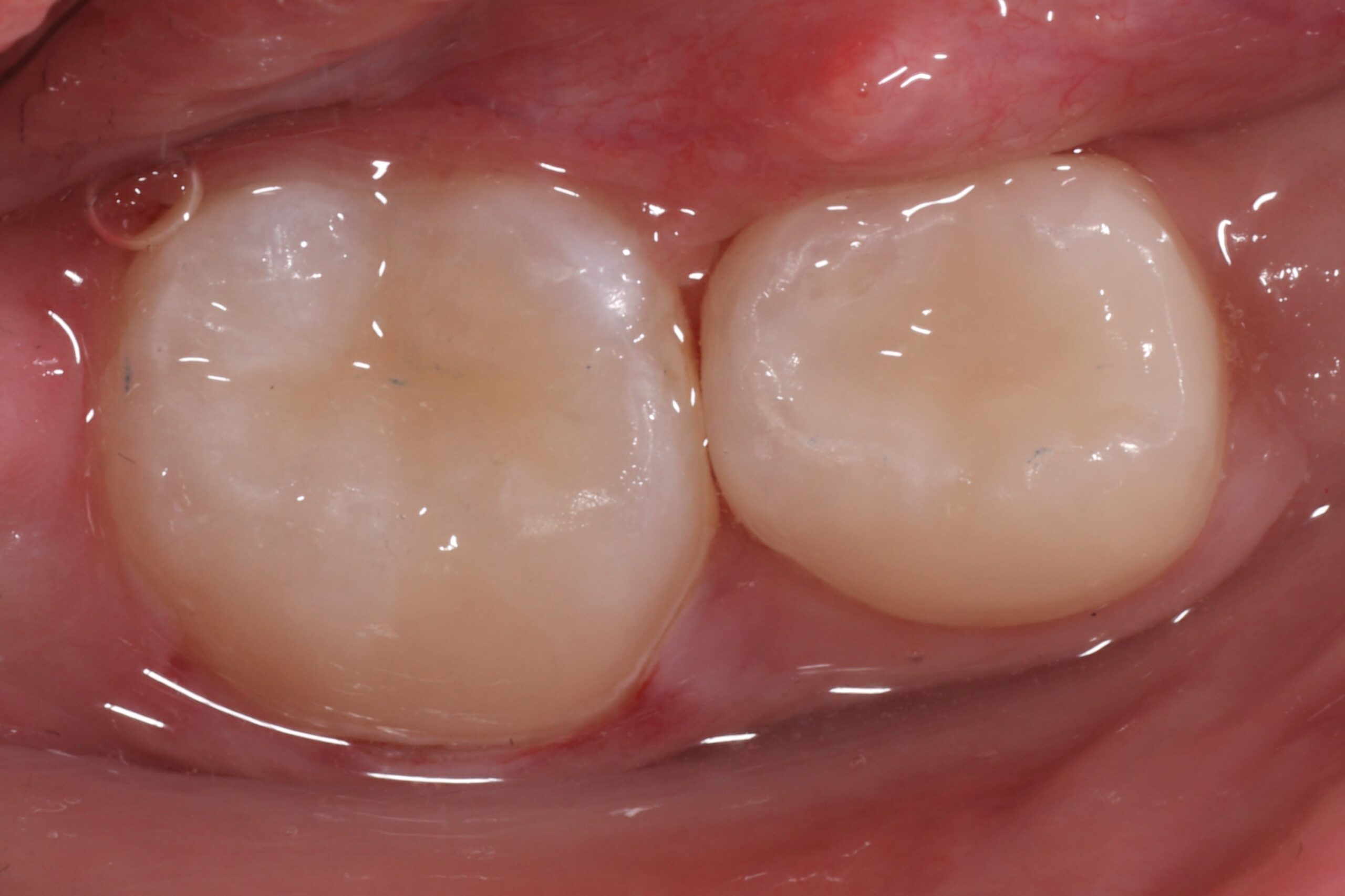 After image