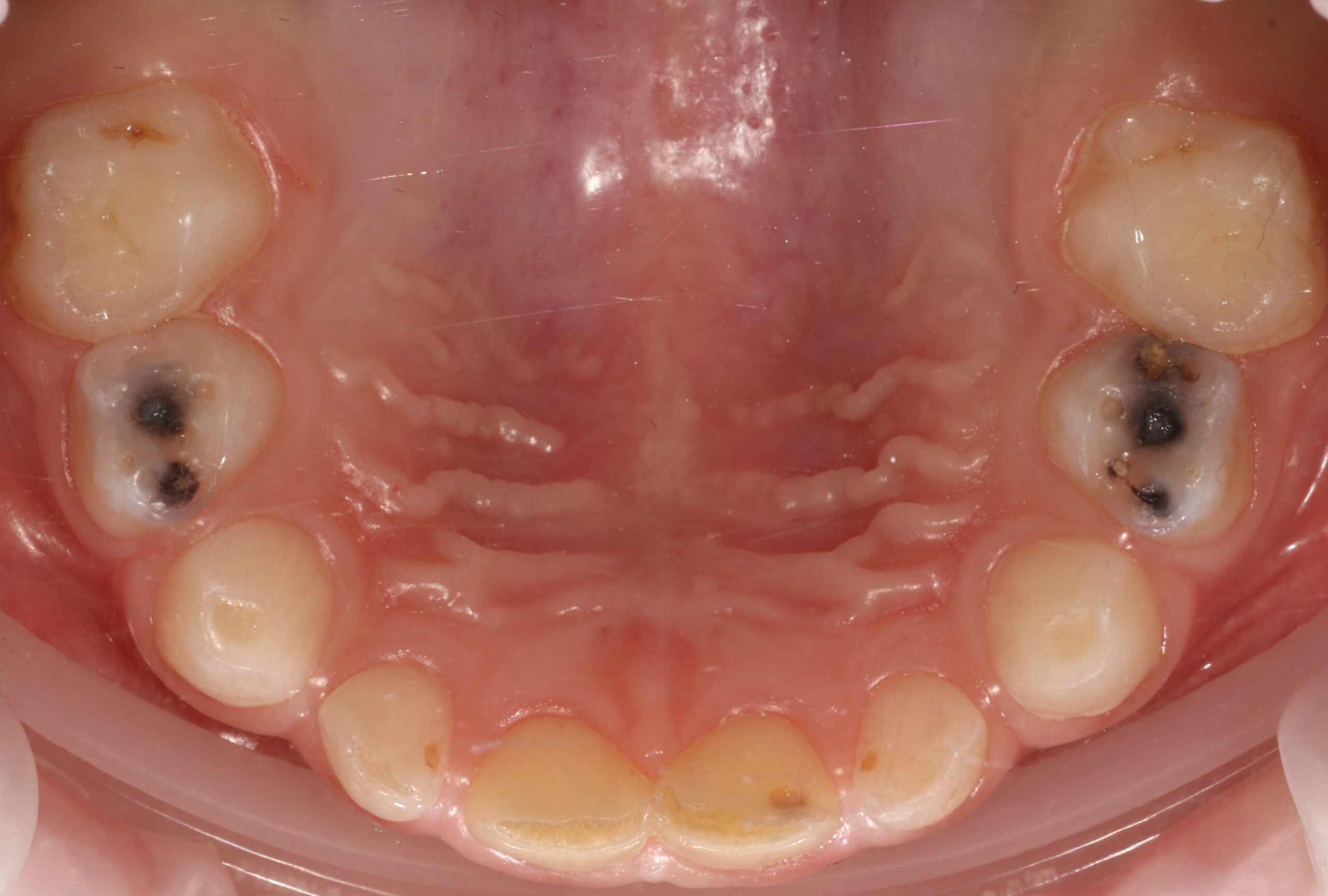Before image