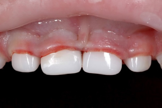After image