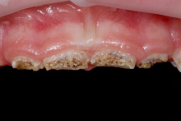 Before image