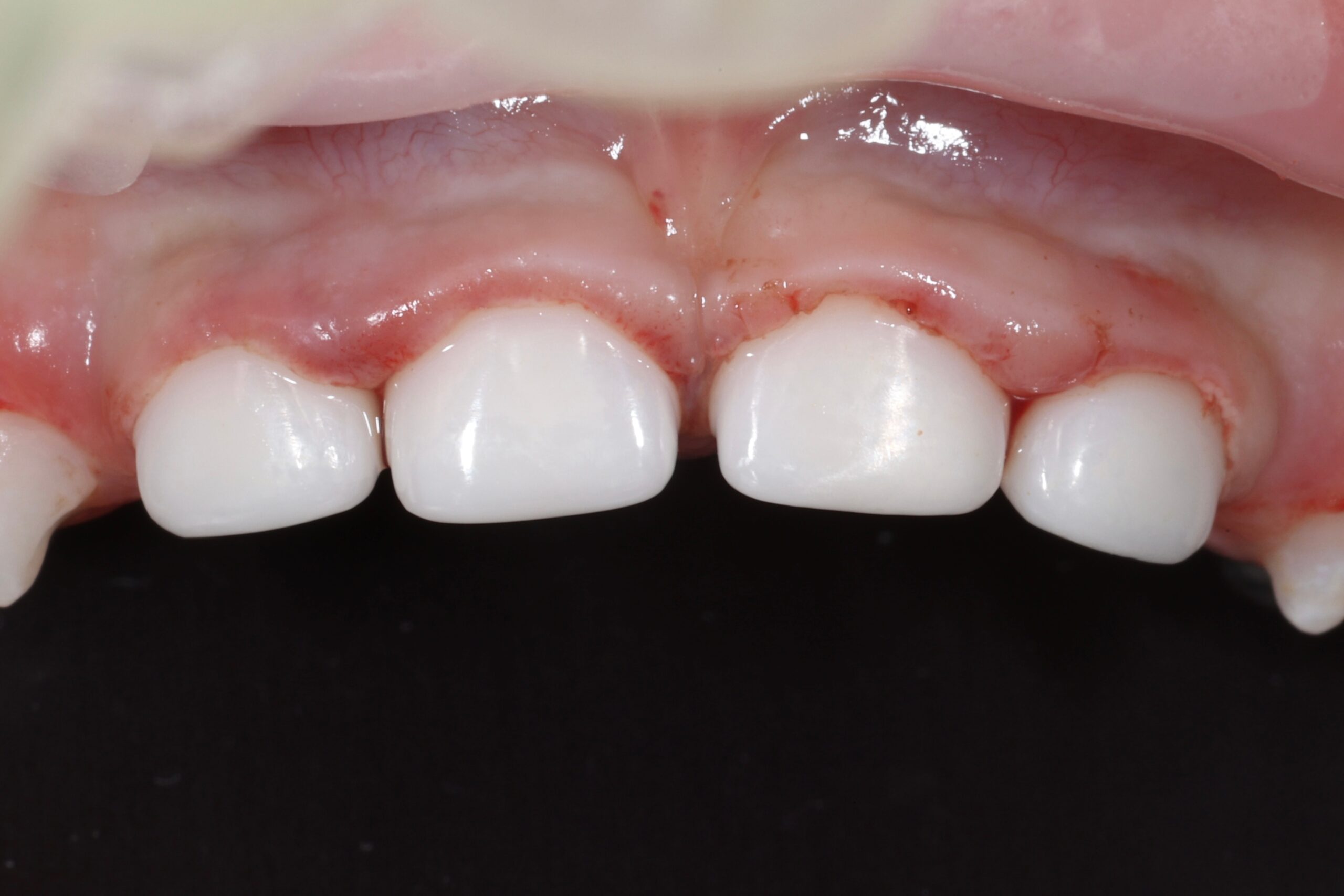 After image