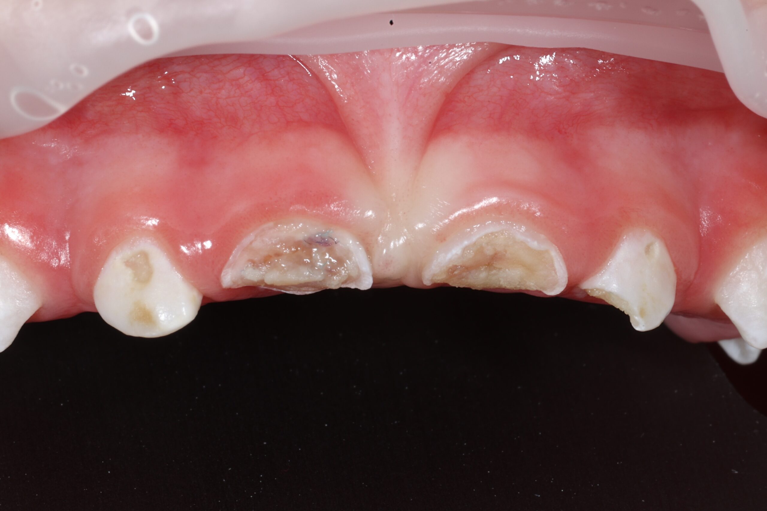Before image