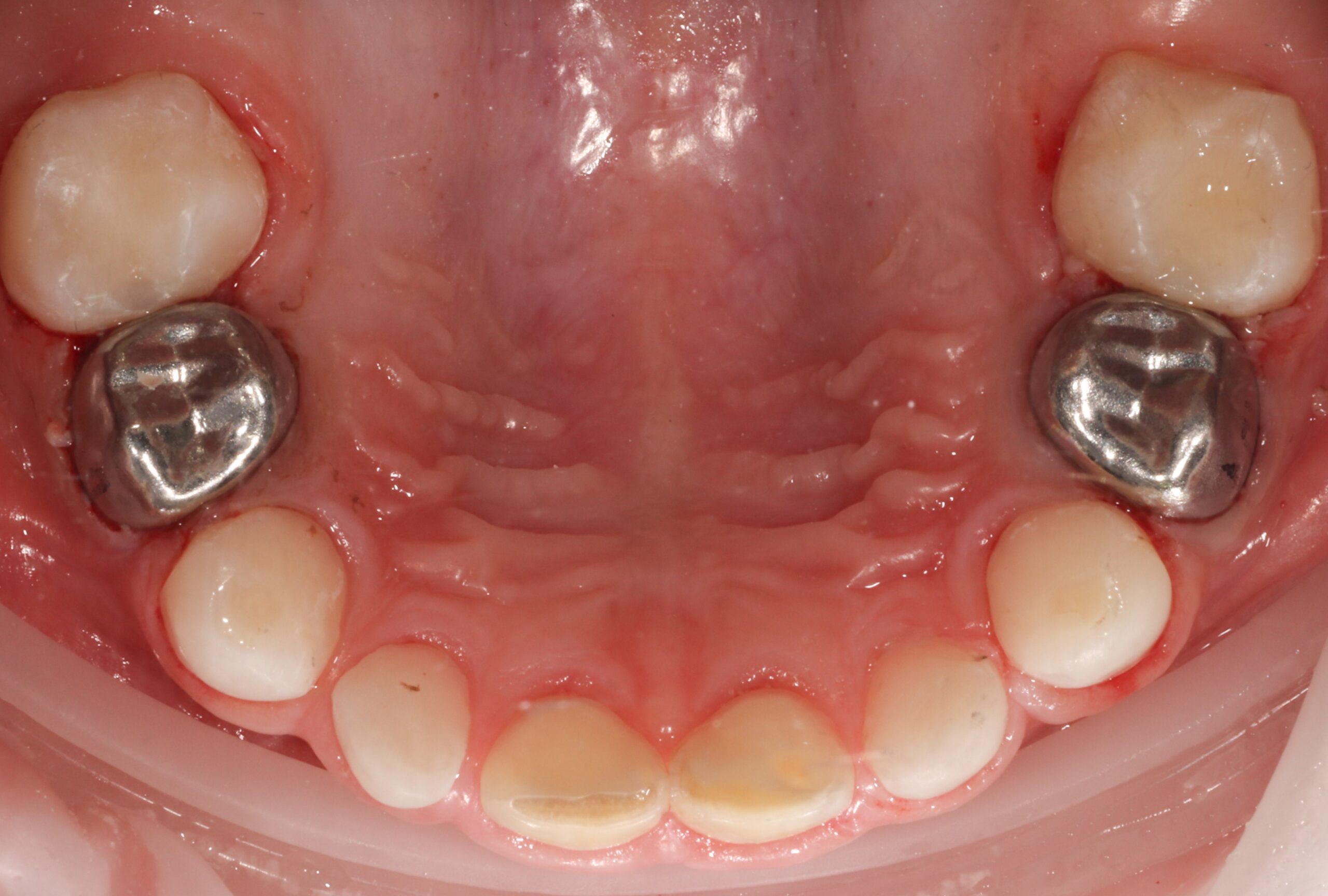 After image
