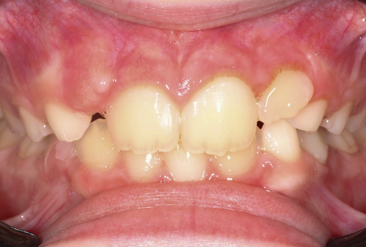 Before image