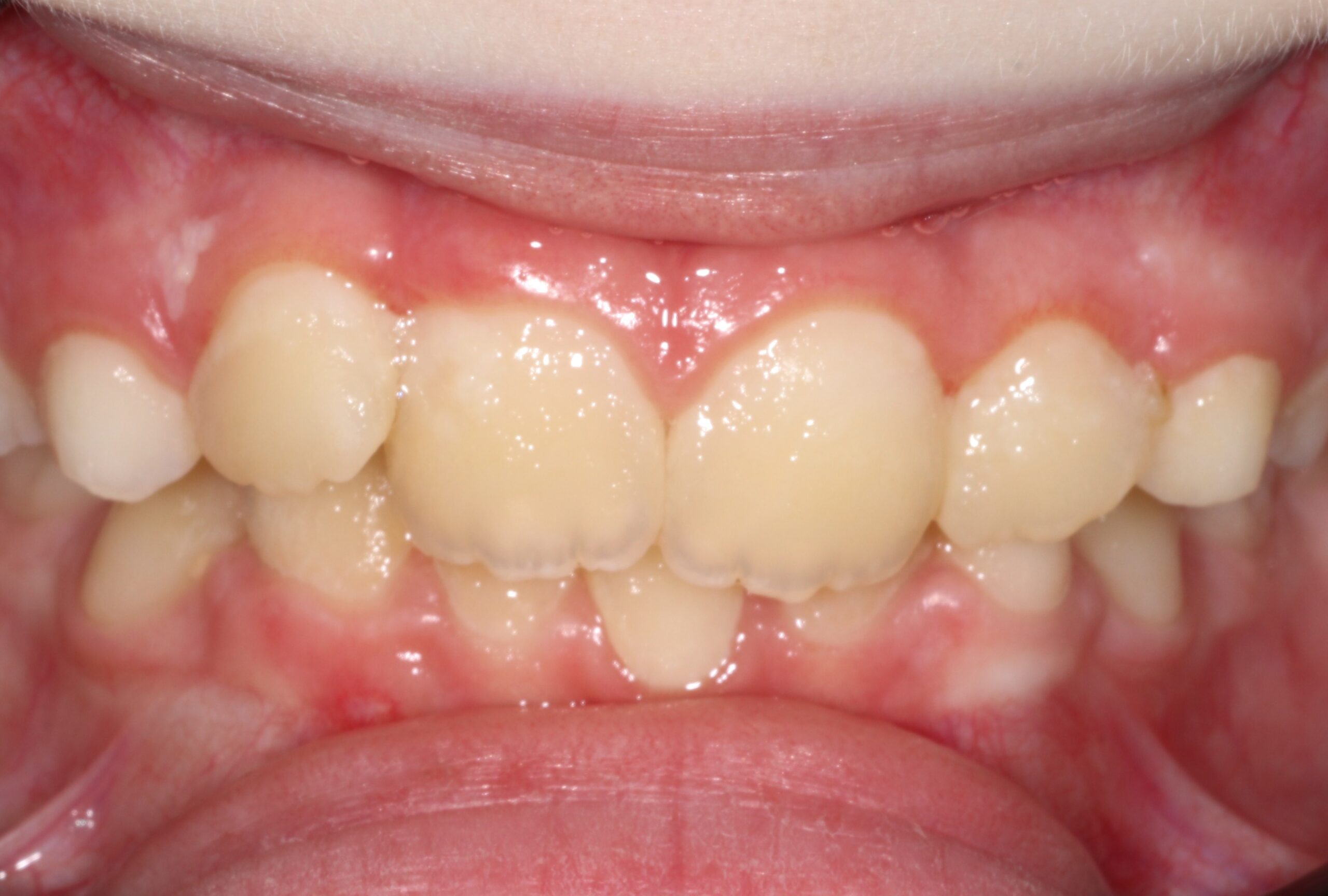 After image