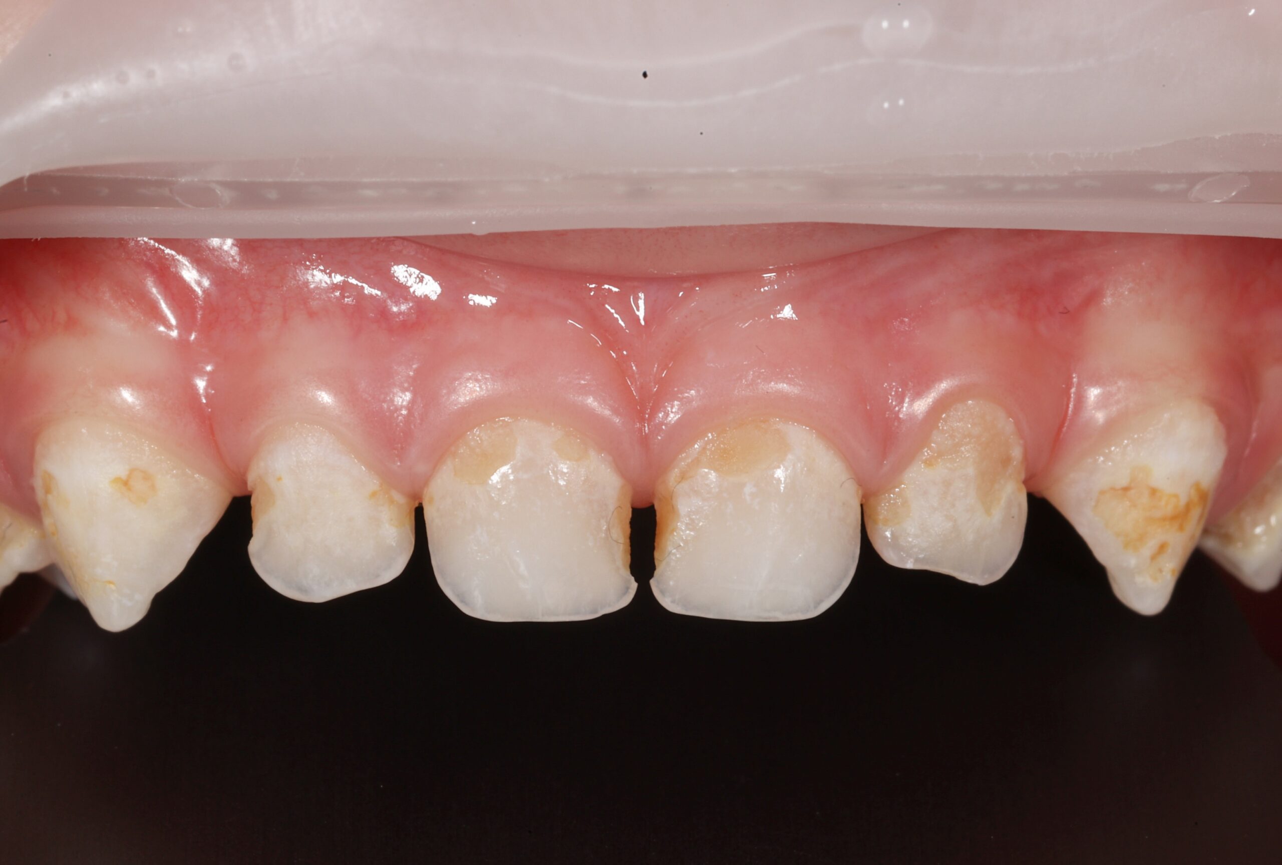 Before image