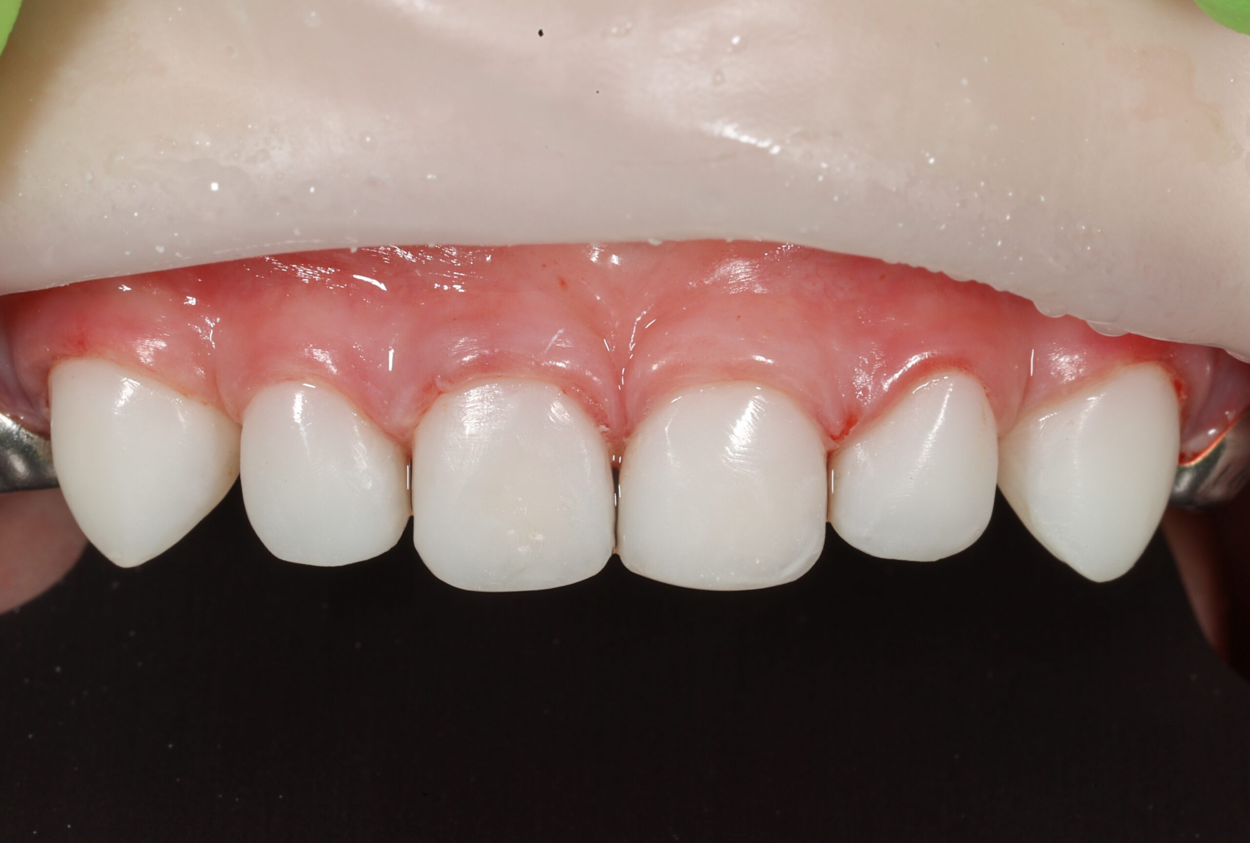 After image