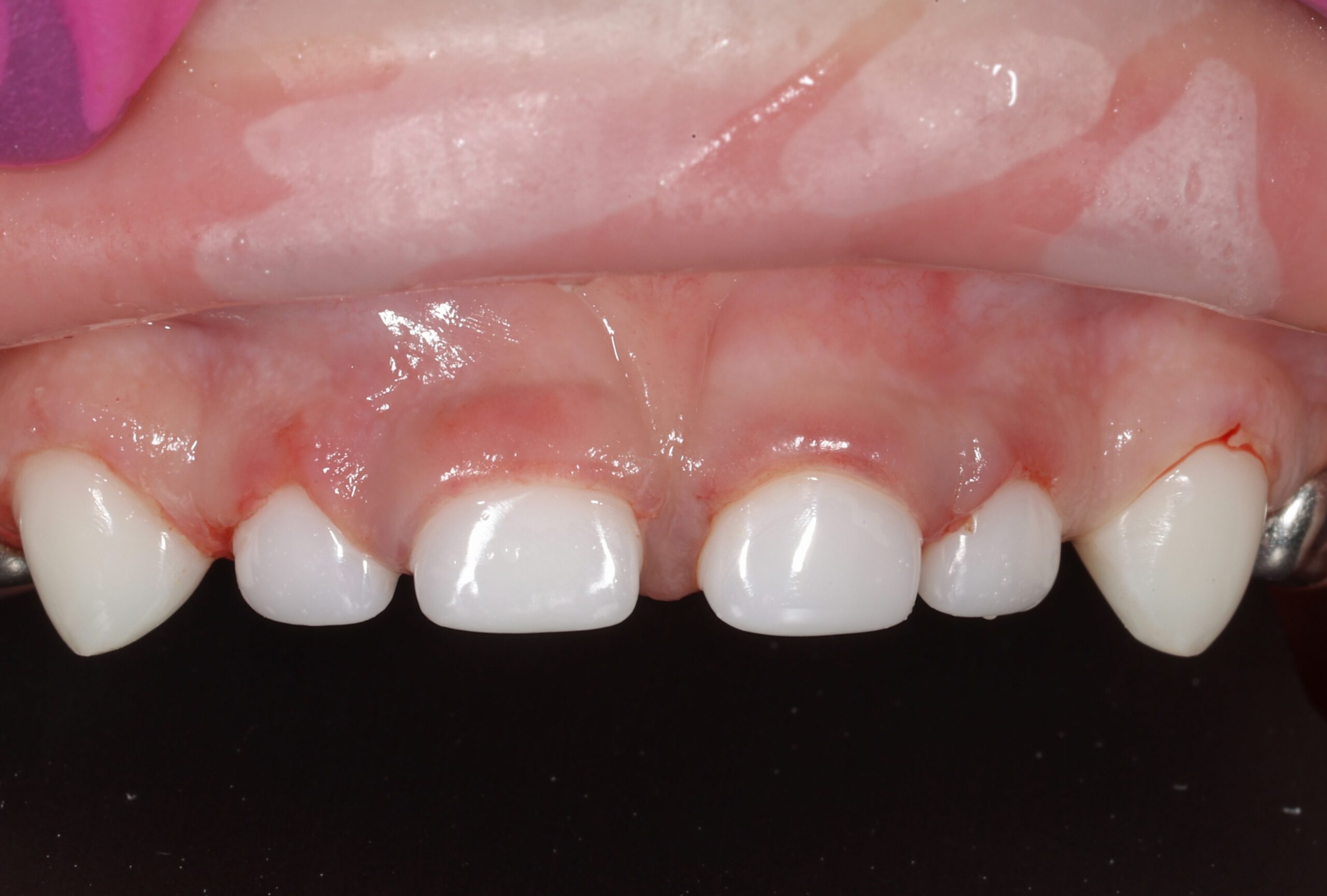 After image