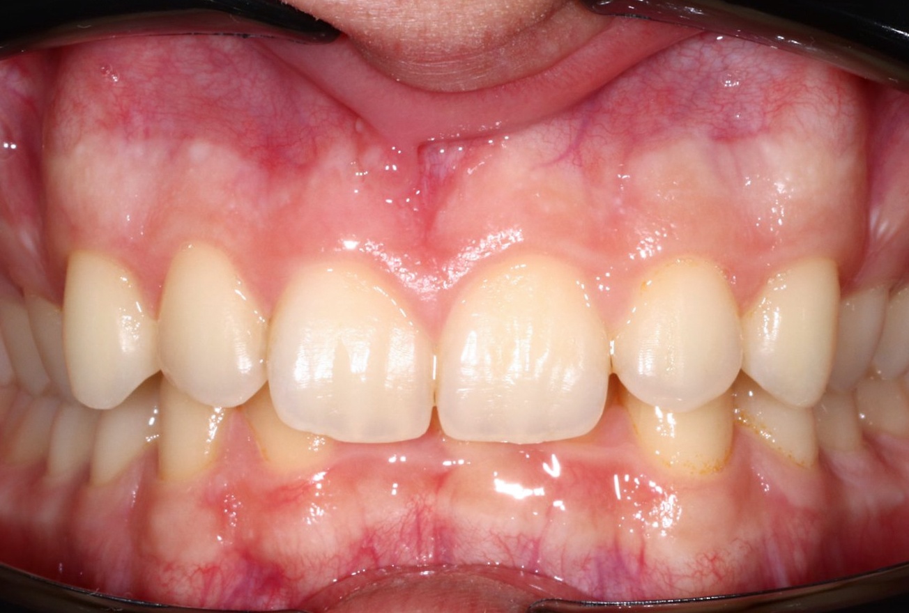 Before image
