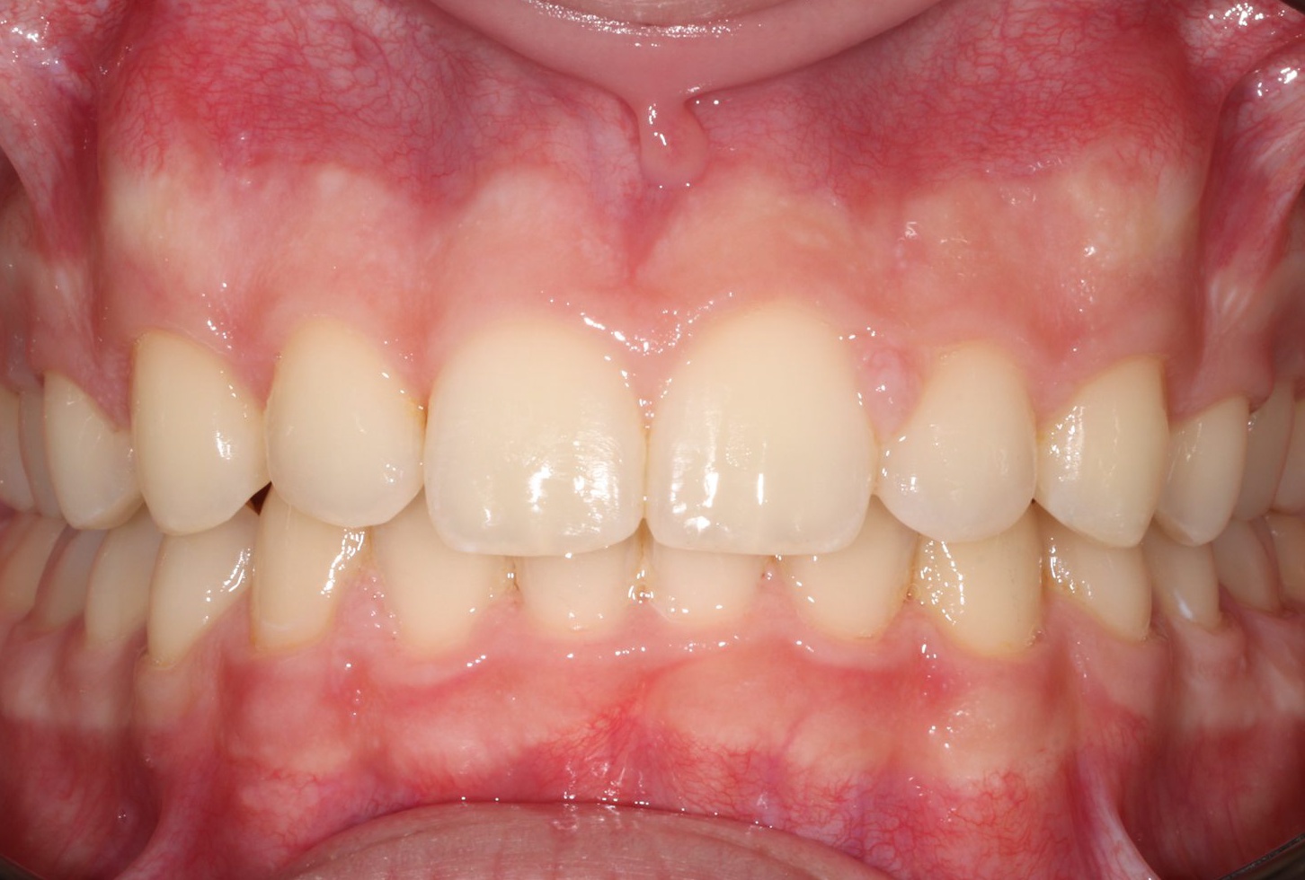 After image