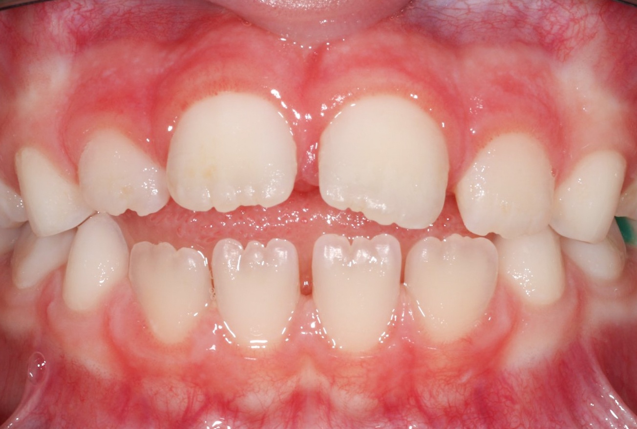 Before image