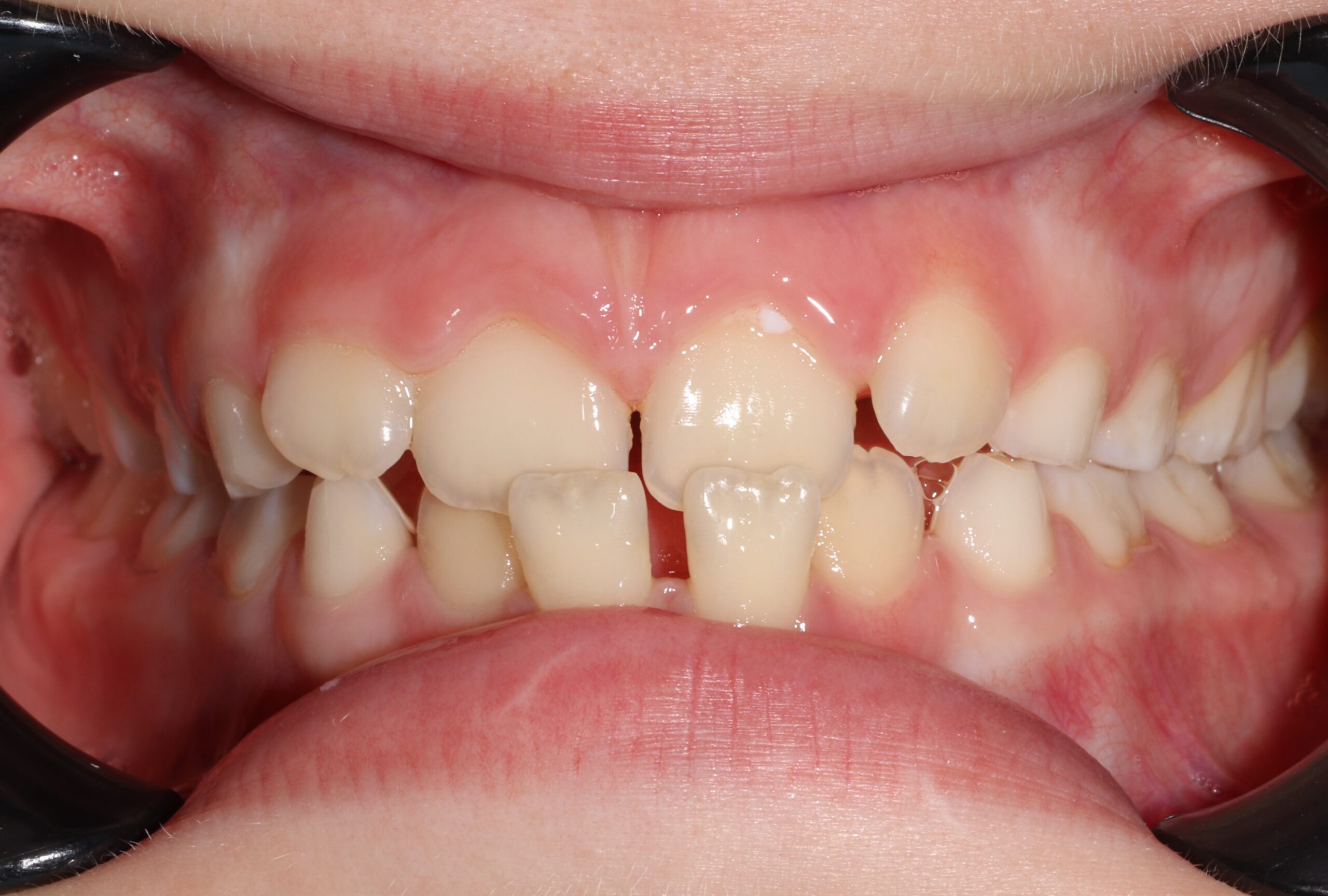 Before image