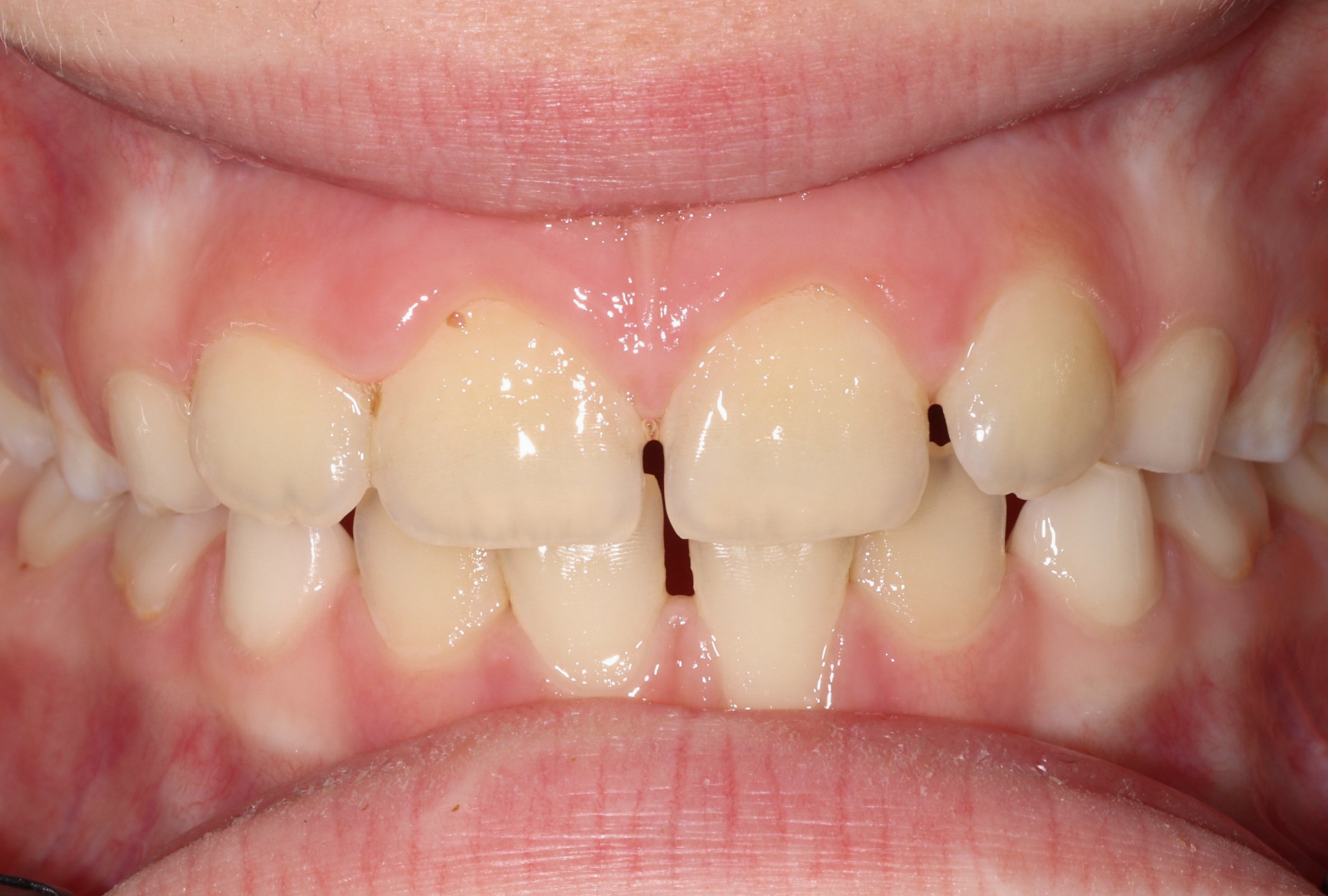 After image