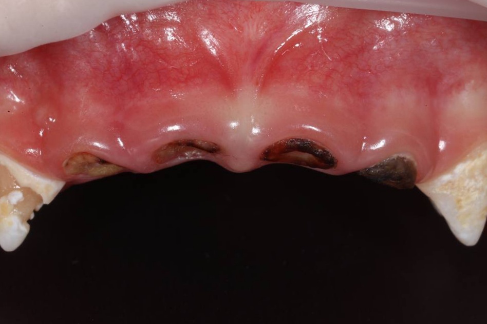 Before image