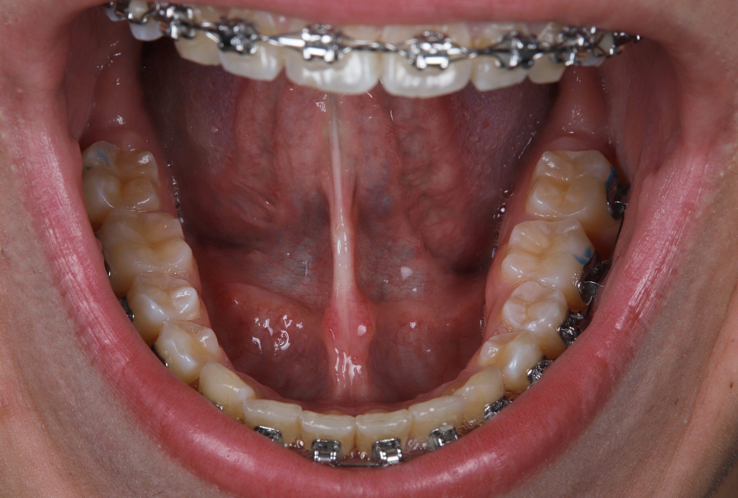 After image