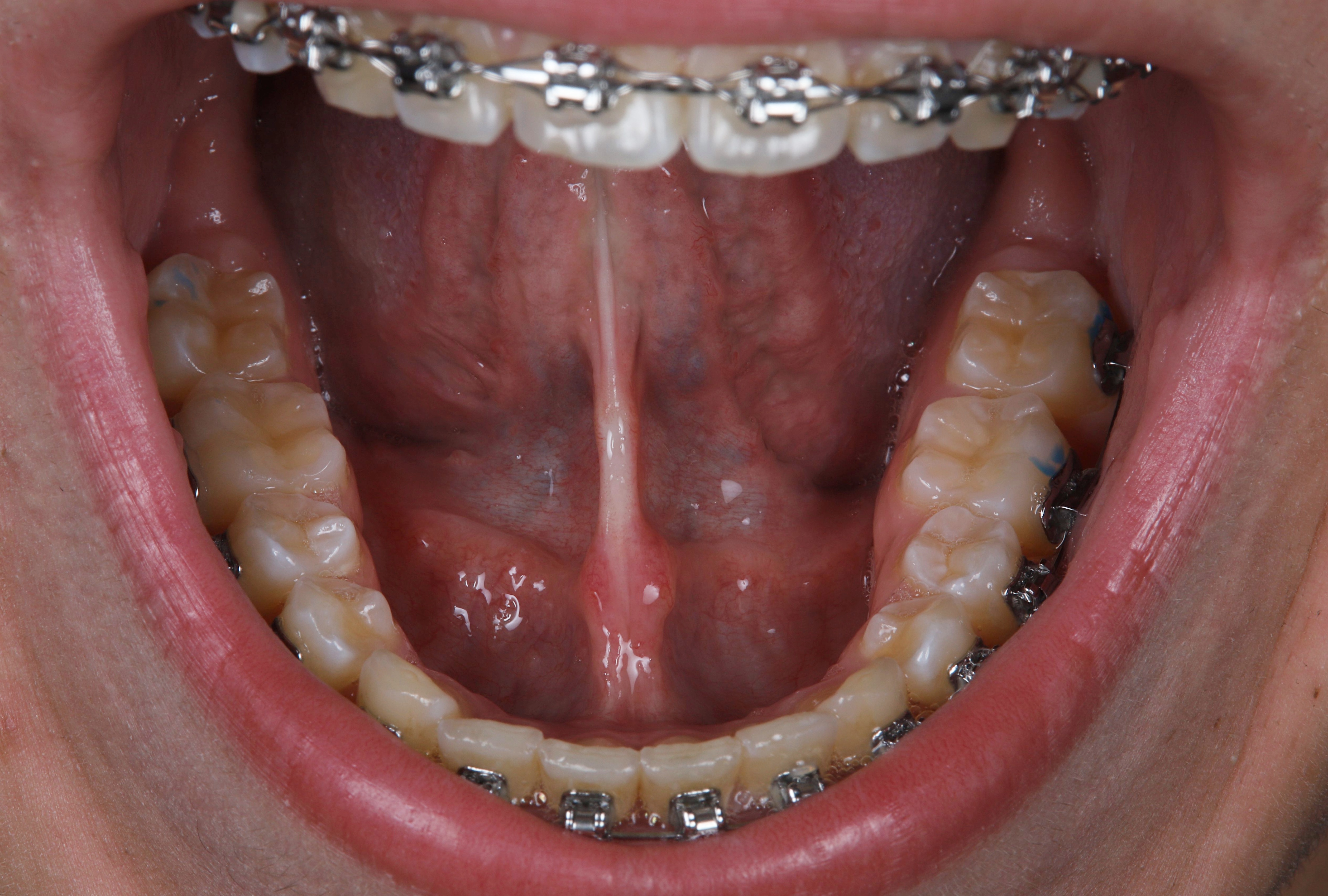 After image