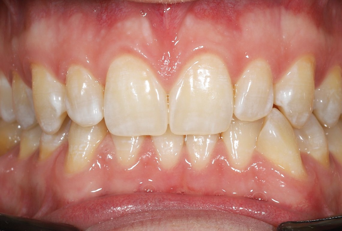 Before image